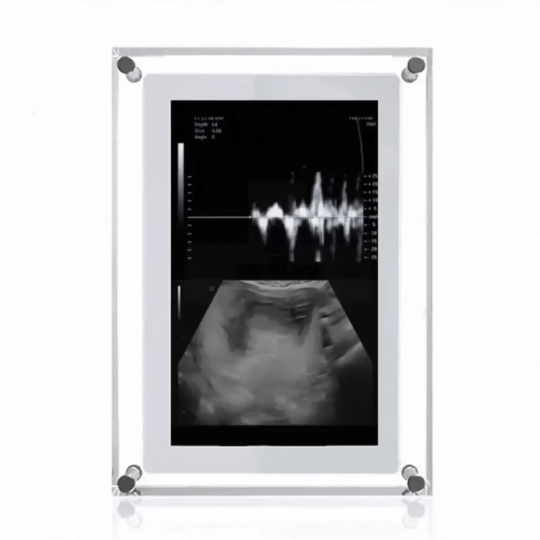 Digital Frame of Infinite Memories