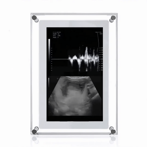 Digital Frame of Infinite Memories