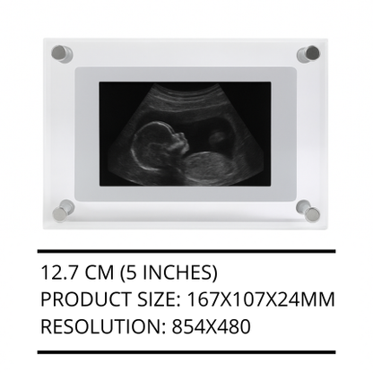 Digital Frame of Infinite Memories