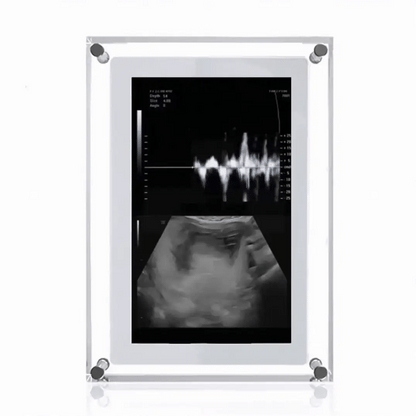 Digital Frame of Infinite Memories