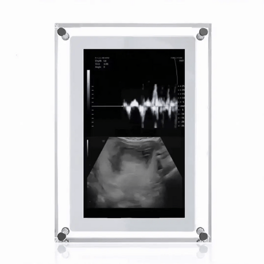 Digital Frame of Infinite Memories